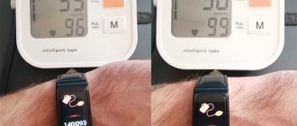TOP 10 smart watches with blood pressure measurement for 2021-2022. Review of the best models 1 